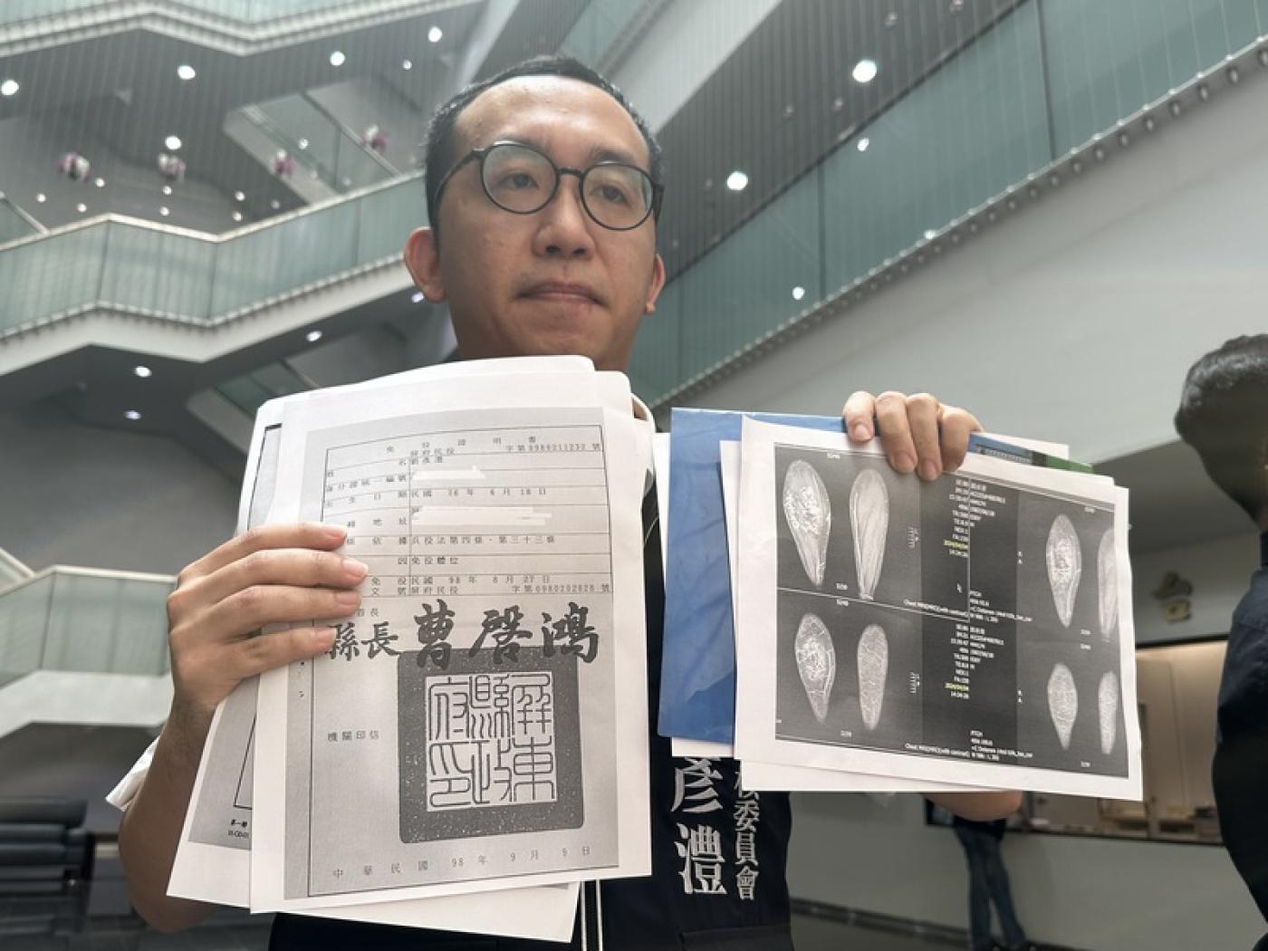 遭質疑特權兵役，劉彥澧出示多張個人體檢資料，說明因長有血管瘤，符合運動障礙功能的免役體位。中央社